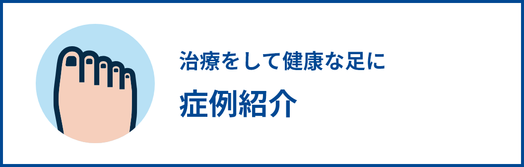 治療をして健康な足に 症例紹介